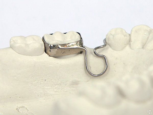 Кольцо на зубы